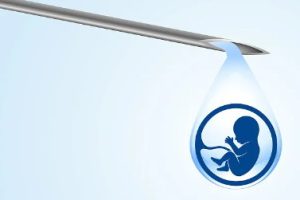 深圳试管婴儿助孕成功后从生殖科转产科需要注意的事项，深圳试管成功后产检必须要重视的检查