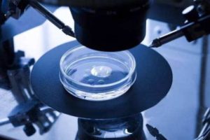 结扎后的男性还可以有孩子吗？男性做结扎手术对自己有什么影响？男性结扎还能做试管婴儿移植吗？