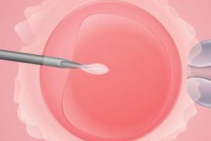 肾上腺疾病症状有哪些？肾上腺功能减退影响潮州试管婴儿吗？