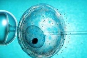 为什么每年都有这么多人去马来西亚做试管婴儿？马来西亚试管婴儿需要什么条件？