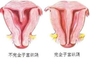 中山试管婴儿移植的胚胎，中山试管婴儿胚胎移植前的准备，中山试管婴儿胚胎移植前吃什么可以有助于着床