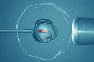 输卵管堵塞积水可以做佛山试管婴儿吗？输卵管堵塞做手术从哪里开刀？输卵管堵塞必须做佛山试管婴儿吗？