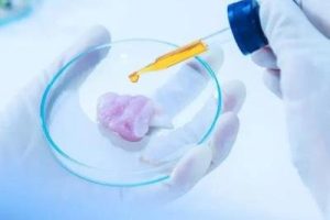 佛山试管婴儿移植后腹水有哪些症状？佛山试管婴儿移植后出现腹水该怎么办？移植后出现腹水现象比较常见吗？