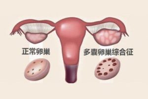 什么情况下可以做潮州试管婴儿？什么情况下不可以做潮州试管婴儿？潮州试管婴儿的具体步骤详述!