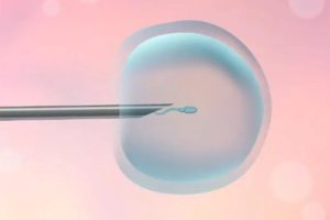 高龄做试管婴儿很难成功？比起提高怀孕率，高龄试管婴儿人群做好这点更重要！