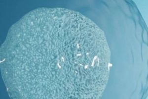 什么叫唐氏综合症？高龄试管婴儿孕妇要做唐筛吗？高龄试管婴儿孕妇做B超的作用？