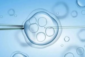 佛山做试管婴儿哪里好