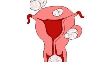 汕头三代试管贵吗