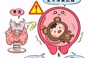 佛山做试管婴儿