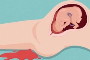 卵子的质量不好做潮州试管还会成功吗