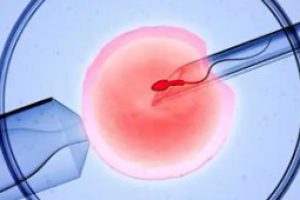 取卵手术的那些疑惑