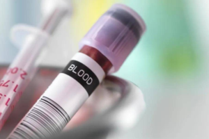 如果丈夫有无精子症,是否可以进行试管婴儿?