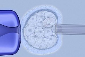 试管婴儿周期方案:详细流程解析与科学饮食建议