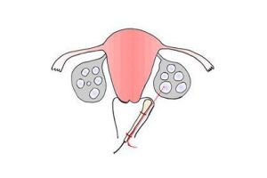 试管婴儿:帮助不孕的夫妻实现梦想,但成功率因人而异——请了解