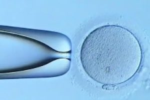 试管婴儿过程中补充雌激素能否提高成功率?