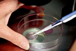 不孕不育女性的常见特征分析