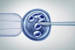 卵巢囊肿达到9厘米,可以考虑进行穿刺吗?这个囊肿的情况严重吗