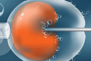 卵泡不破裂与子宫内膜问题之间存在关联吗?