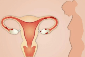 卵泡数量多可能会增加怀双胞胎的机会,但卵泡多并不一定是好事