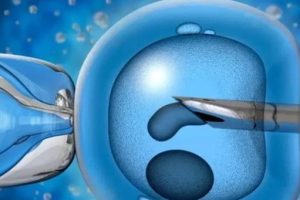 体检报告上显示有畸胎瘤?别着急!