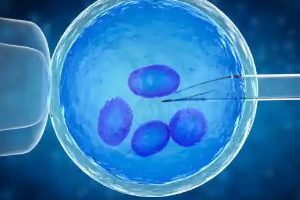 宫内节育器(IUD)异物感的判断与安全应对指南