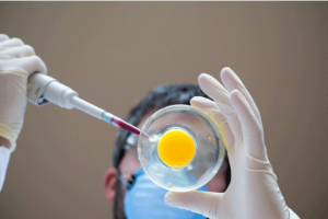 三个月使用优思明治疗多囊卵巢综合征的效果如何?需要注意哪些事