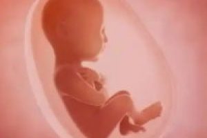 多囊卵巢是否容易怀上双胞胎?怀孕后是否需要进行保胎?