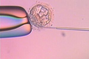 如何理解妊娠检测中的“阴性”结果?避免17%误判率的关键指南