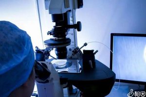 节育环多久更换一次?可以终生不取吗?——科学使用指南