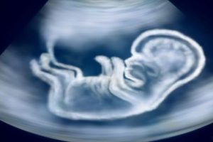 优思明和妈富隆:30%