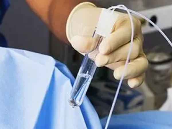 无排卵症可以进行试管婴儿吗?关键问题全面解读