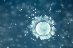 月经周期超声检查显示卵巢正常但没有卵泡?了解原因及应对方法请