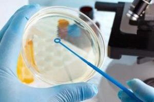 润巢素是一种帮助调节卵巢功能的保健品,但不能替代卵巢早衰的药