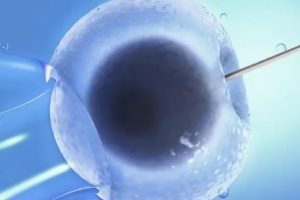 在试管婴儿过程中,生气真的会导致卵泡提早破裂吗?