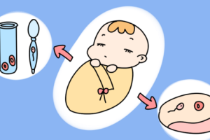 三代试管医院怎么选？选对pgt医院