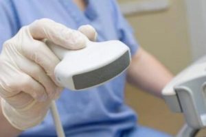 辅助生殖技术（art）费用全面解析