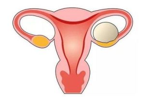 试管婴儿费用拆解：3万到15万差在哪？一篇说清