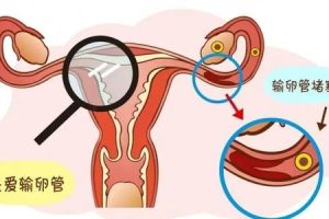 南昌试管婴儿技术现状及高成功率机构指南