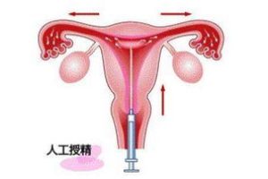 试管促排期间雌二醇对照表：解读要点速查