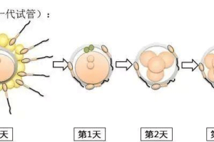 试管婴儿受精率：正常范围、影响因素及应对方法