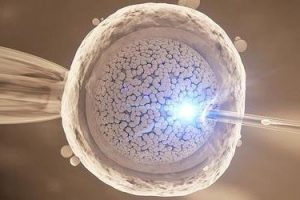 第三代试管婴儿（pgt）国家选择指南