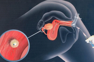 如何选择苏州的生育中心？没有“最好”，只有“最适合”