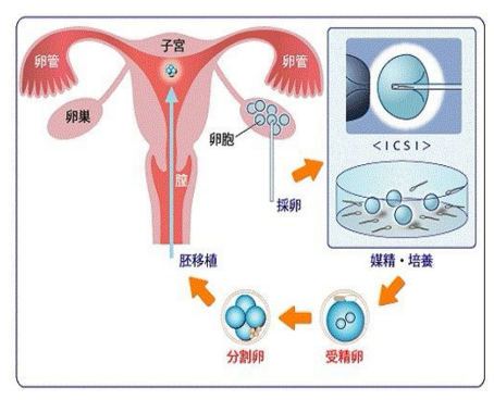 试管包男孩多少钱