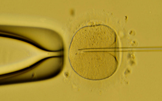 试管婴儿多少钱