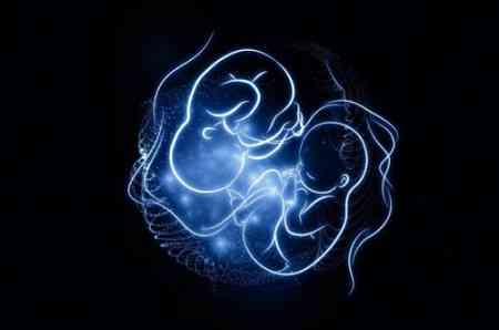 备孕,试管婴儿,试管技术