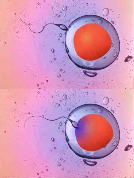 试管婴儿,卵巢衰老,不孕不育