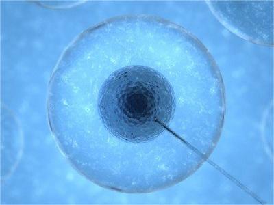 美国试管婴儿,第三代试管技术,试管婴儿