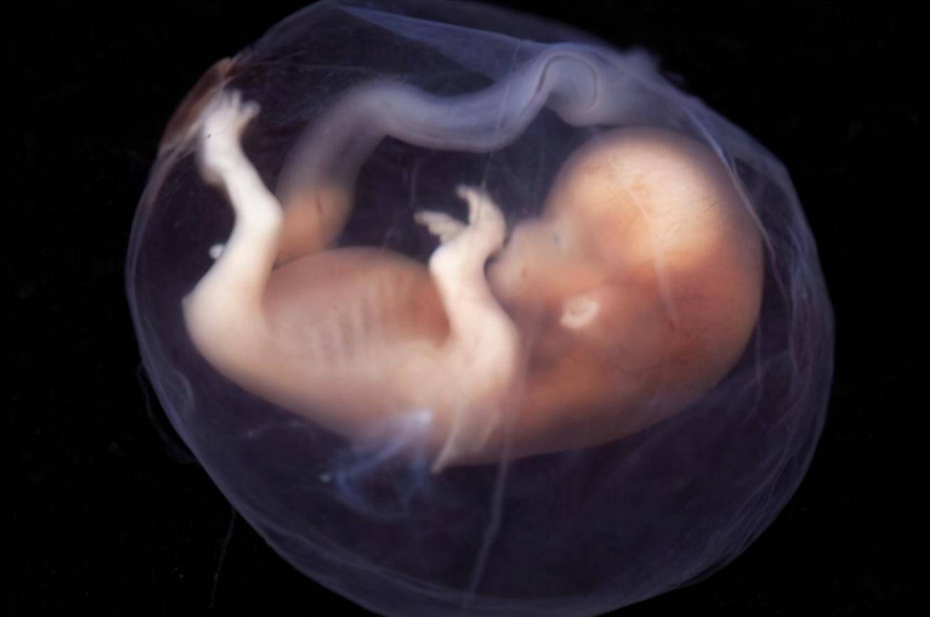 第一代试管婴儿,第二代试管婴儿,第三代试管婴儿