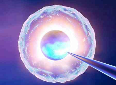 试管技术操作,助孕,卵巢功能