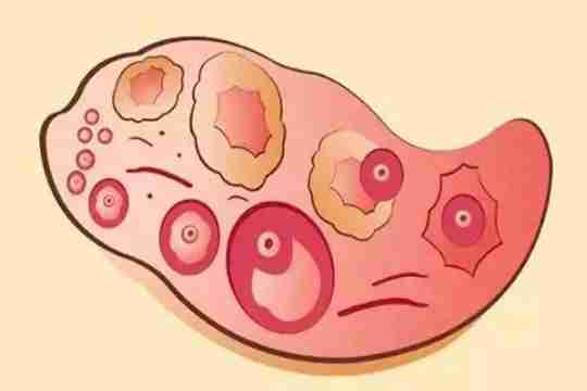 卵泡发育慢怎么做试管婴儿?